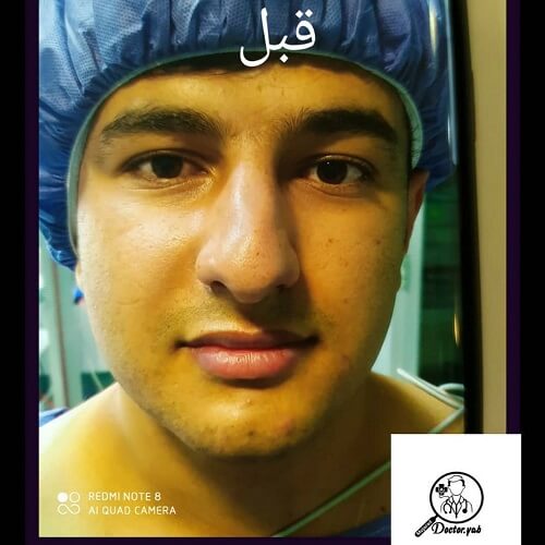 بهترین جراح بینی شیراز