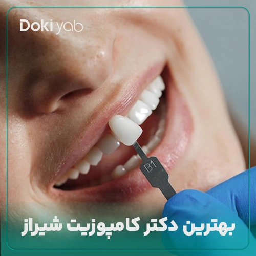 معرفی بهترین دکتر کامپوزیت شیراز در مجله دکی یاب