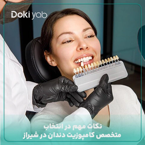 نکات مهم در انتخاب متخصص کامپوزیت دندان در شیراز