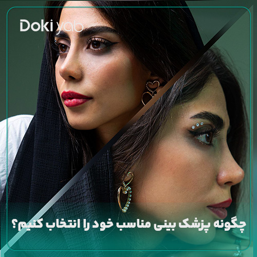 نحوه انتخاب پزشک بینی مناسب در دکی یاب