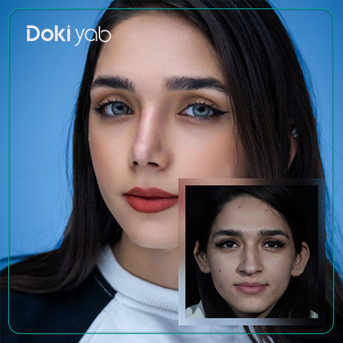 تصویر قبل و بعد جراحی بینی با بهترین پزشکان با مشاوره دکی یاب