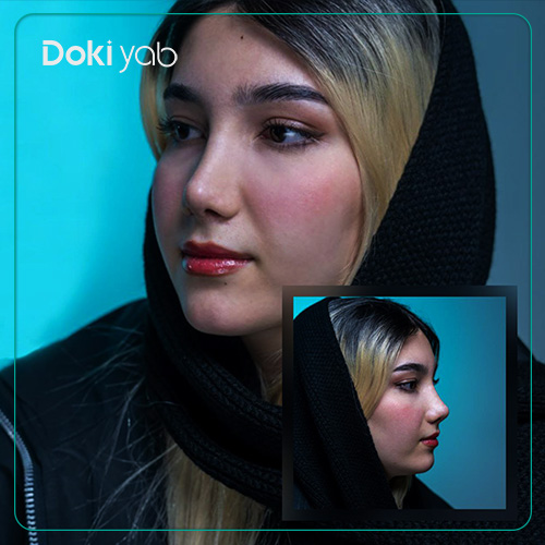 نمونه کار عمل بینی با پزشک متخصص در دکی یاب