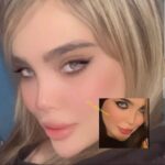 عمل بینی قسطی در شیراز - 12 ماهه و بدون ضامن بینی خود را به صورت اقساطی جراحی کنید!