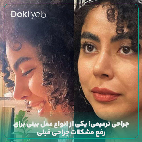 نمونه جراحی ترمیمی در دکی یاب