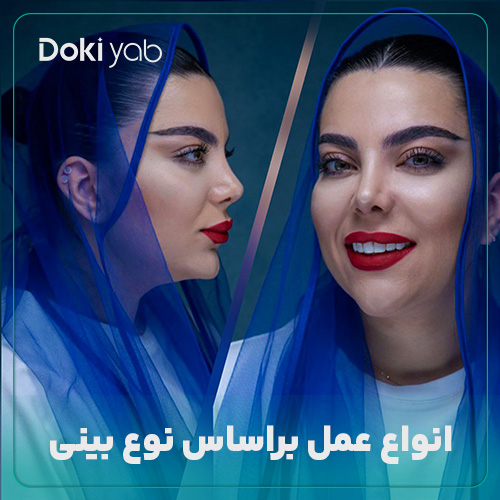 انواع عمل بینی براساس نوع بینی؛ نمونه بینی عملب با مشاوره دکی یاب