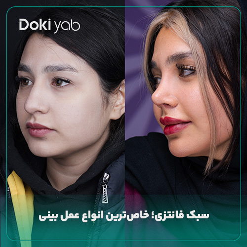 عمل بینی فانتزی در مجموعه دکی یاب؛ صفحه انواع عمل بینی