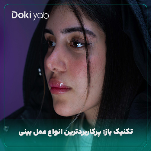 تکنیک باز یکی از انواع عمل بینی؛ نمونه جراحی بینی در دکی یاب