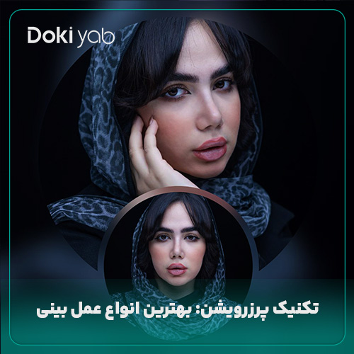 عمل پرزرویشن یکی از انواع عمل بینی؛ نمونه جراحی با دکی یاب