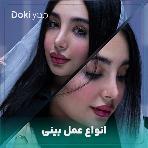 انواع عمل بینی در مجله دکی یاب