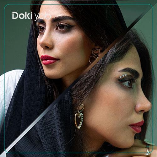 نمونه جراحی بینی با دکی یاب؛ مقاله مراقبت‌های بعد از عمل بینی