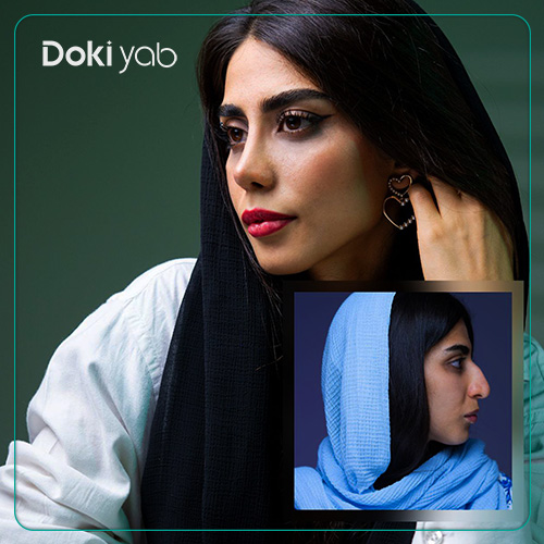 نمونه جراحی بینی با مشاوره مجموعه دکی یاب
