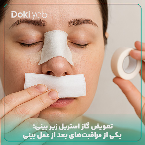 تعویض گاز استریل زیر بینی بعد از عمل، یکی از بخش‌های مهم مراقبت‌های بعد از عمل بینی