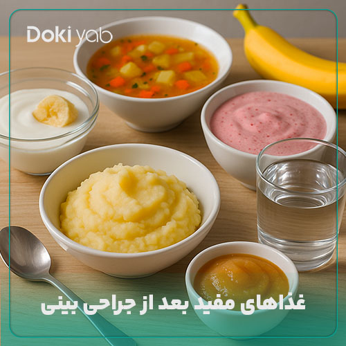 غذاهای خوب در دوران مراقبت‌های بعد از عمل بینی