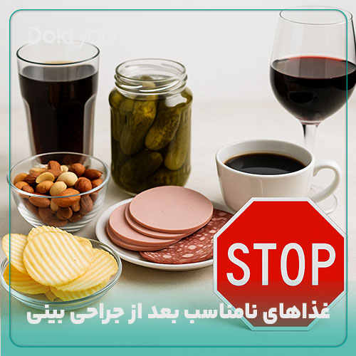 غذاهای نامناسب بعد از جراحی بینی