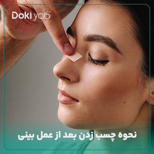 نحوه چسب زدن بعد از عمل بینی در دکی یاب