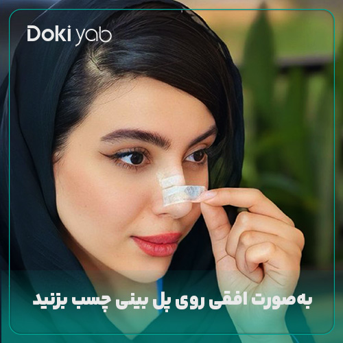چسب زدن افقی روی پل بینی