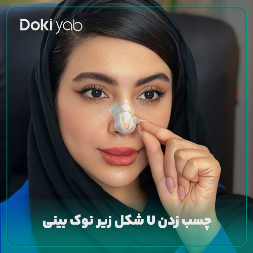 چسب زدن U شکل زیر نوک بینی