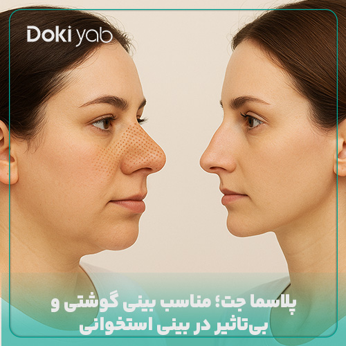 تاثیر پلاسما جت روی بینی استخوانی و گوشتی
