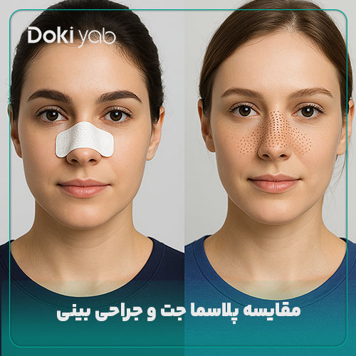 مقایسه پلاسما جت و جراحی بینی