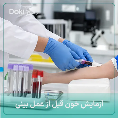 آزمایش های قبل از جراحی بینی برای بررسی خون