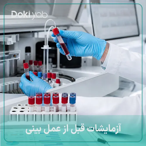 آزمایشات قبل از عمل بینی