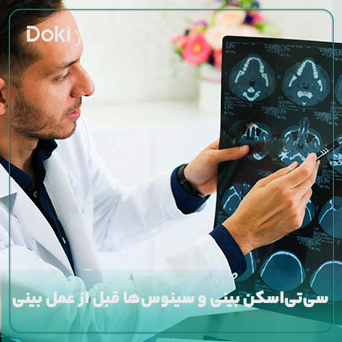 سی‌تی‌اسکن بینی و سینوس‌ها؛ یکی از آزمایشات قبل از عمل بینی