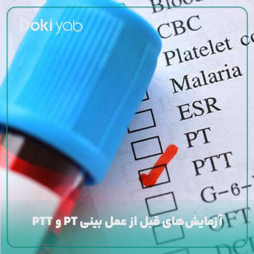 آزمایش‌های قبل از عمل بینی PT و PTT