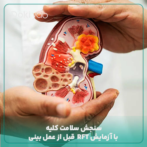 آزمایش قبل از عمل بینی RFT