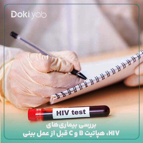 انجام تست ایدز و هپاتیت؛ یکی از آزمایشات قبل از عمل بینی