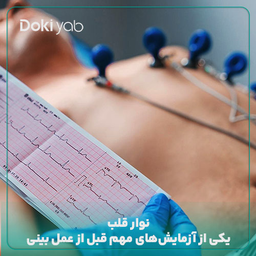 نوار قلب یکی از آزمایش‌های مهم قبل از عمل بینی