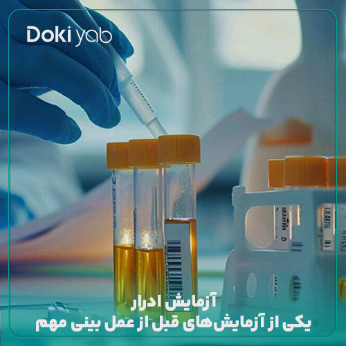 آزمایش ادرار قبل از عمل بینی
