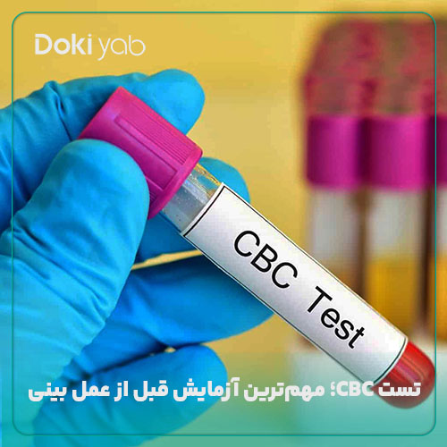 تست CBC یکی از مهم‌ترین و اصلی‌ترین آزمایش‌های قبل از عمل بینی