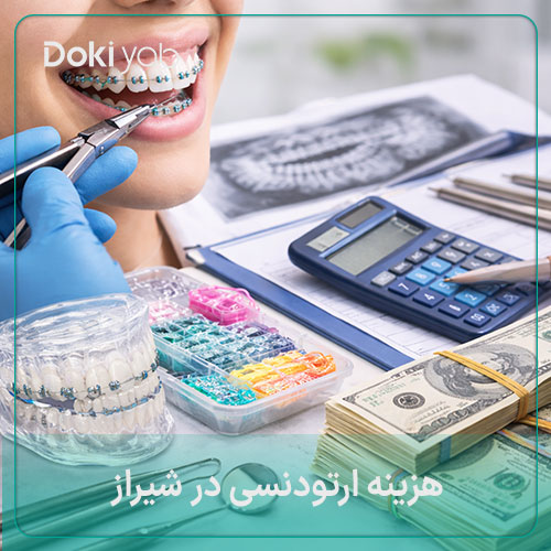 هزینه ارتودنسی در شیراز