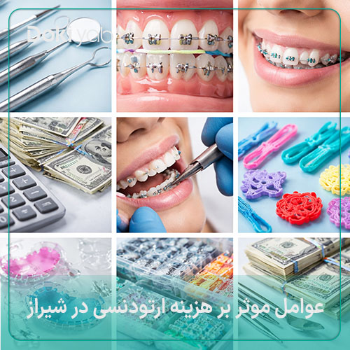 بررسی عوامل موثر بر هزینه ارتودنسی در شیراز