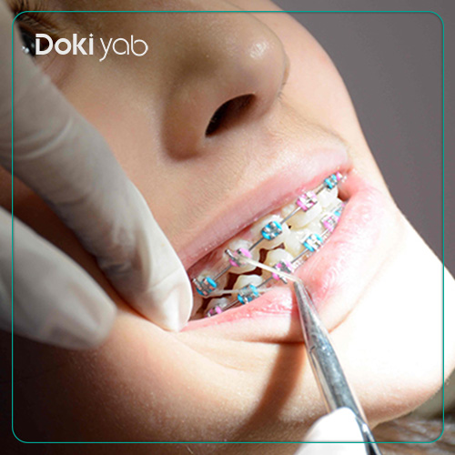 تاثیر سن در هزینه ارتودنسی در شیراز