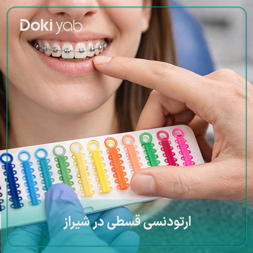 ارتودنسی ارزان در شیراز