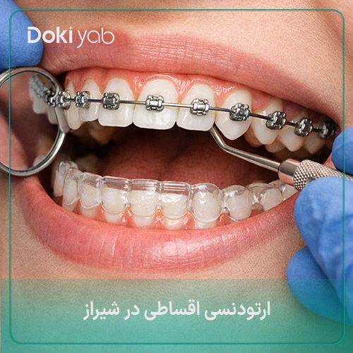 ارتودنسی اقساطی در شیراز