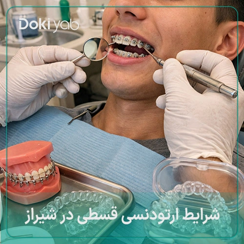 شرایط دقیق ارتودنسی قسطی در شیراز در دکی یاب