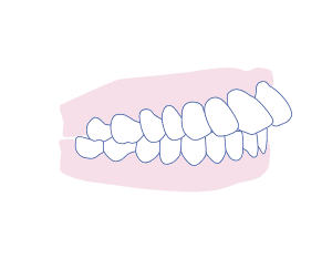 روش های ارتودنسی دندان