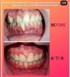 کلینیک ارتودنسی دندان در شیراز اقساطی