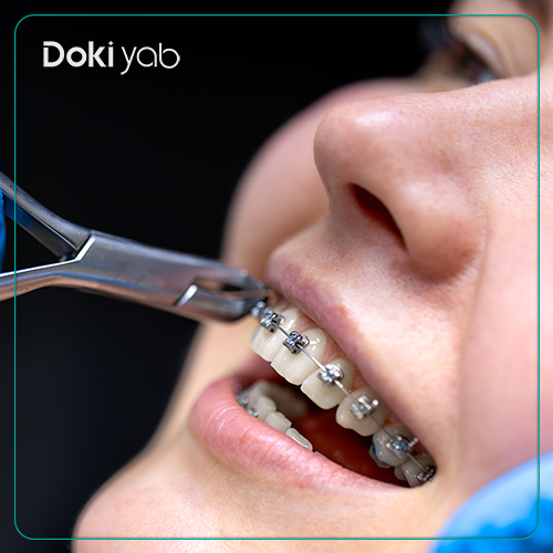 ویژگیهای بهترین دکتر ارتودنسی در شیراز