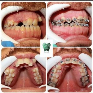 دکتر خدیجه مینا متخصص ارتودنسی دندان در شیراز