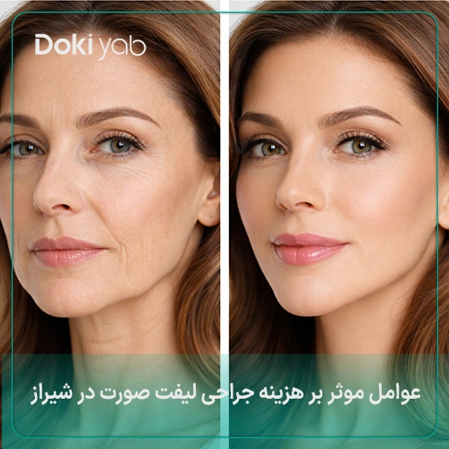 بررسی فاکتورهای موثر بر هزینه جراحی پلاستیک صورت در شیراز