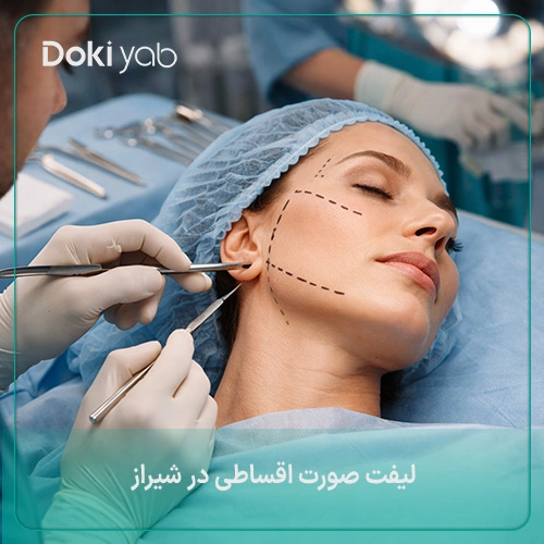 شرایط لیفت صورت اقساطی در شیراز