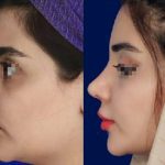 دکتر محسن روشنی جراح زیبایی بینی شیراز |نمونه کار، نظرات، نوبتگیری، هزینه1402
