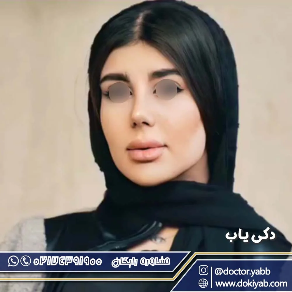 دکتر حسین مرادیان؛ نمونه جراحی بینی در شیراز