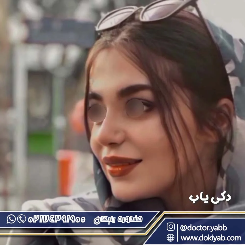 عمل بینی در شیراز؛ نمونه کار دکتر حسین مرادیان