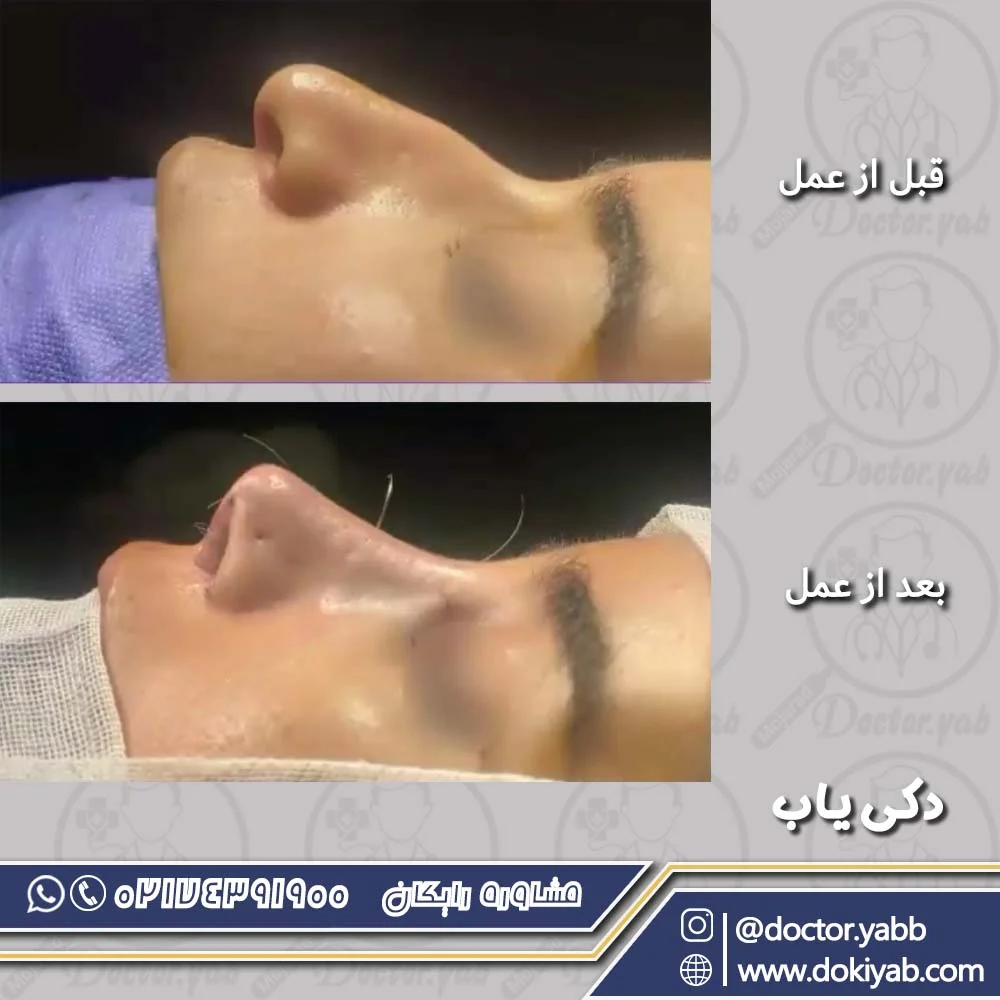 نمونه عمل بینی در شیراز؛ دکتر حسین مرادیان