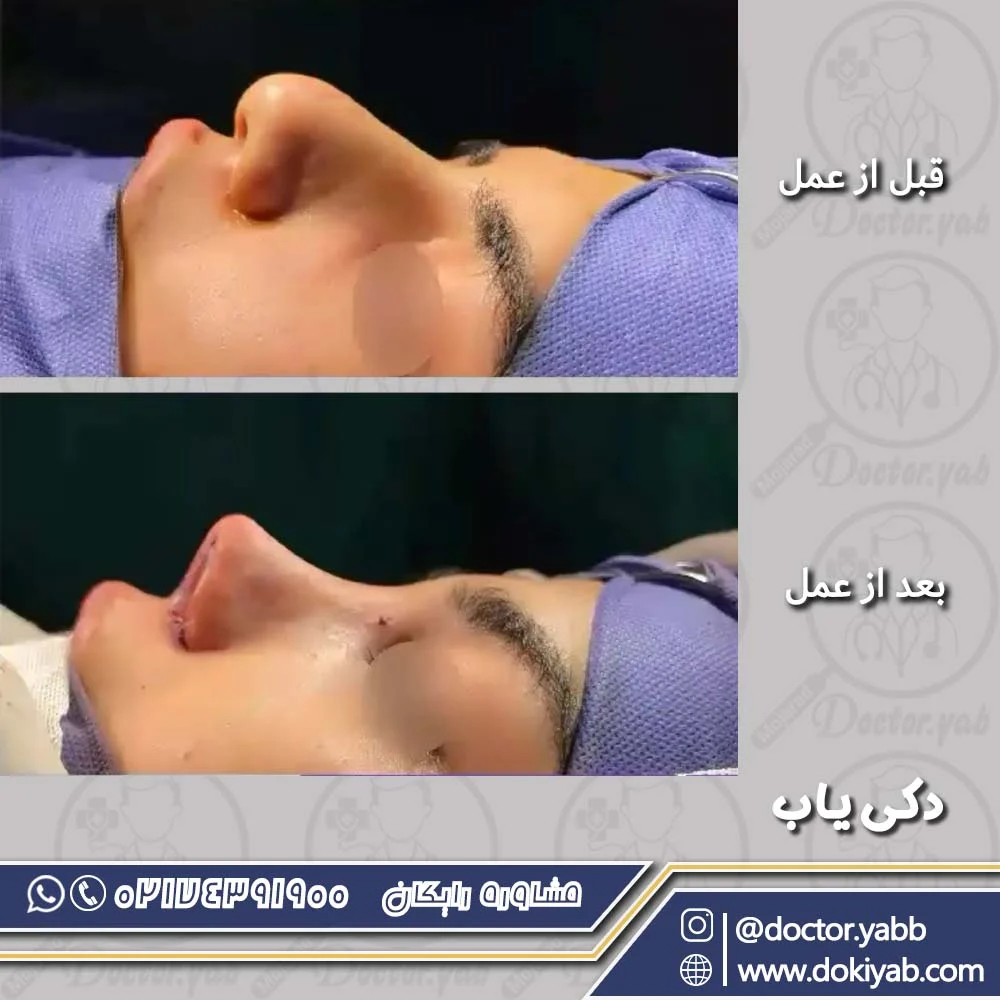 دکتر حسین مرادیان؛ نمونه عمل بینی در شیراز