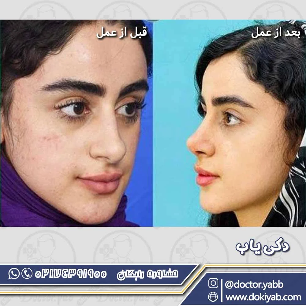 نمونه کار عمل بینی؛ دکتر سلمان شاکری